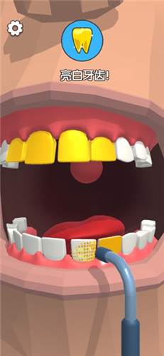 疯狂牙科医生手机游戏